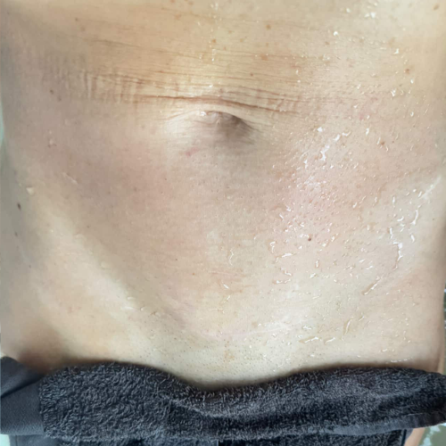 After Image